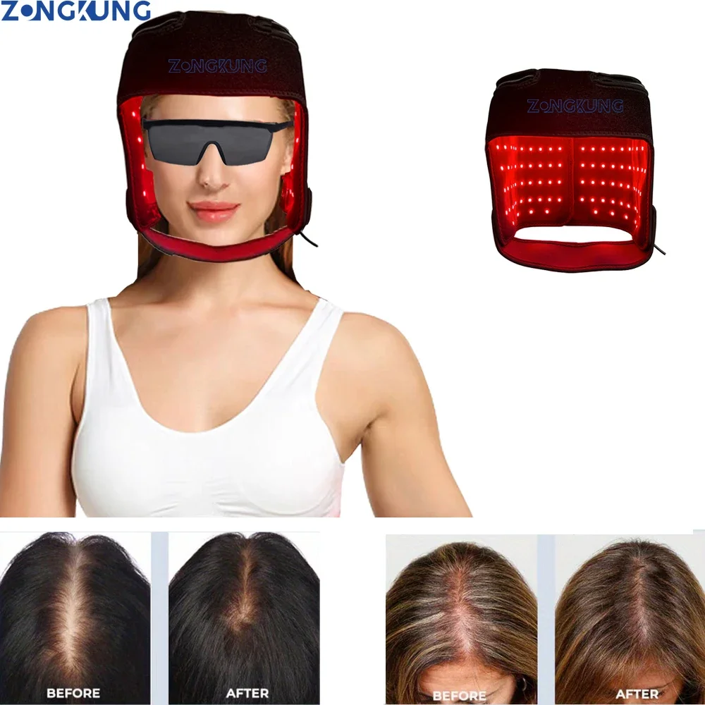 Hair Regrowth Cap Reduces Oiliness Deep Into Hair Follicles Anti-Hair Loss Relieve Fatigue Plug-in Relieves Fatigue Dropshipping
Hair Regrowth Cap Reduces Oiliness Deep Into Hair Follicles Anti-Hair Loss Relieve Fatigue Plug-in Relieves Fatigue Dropshipping