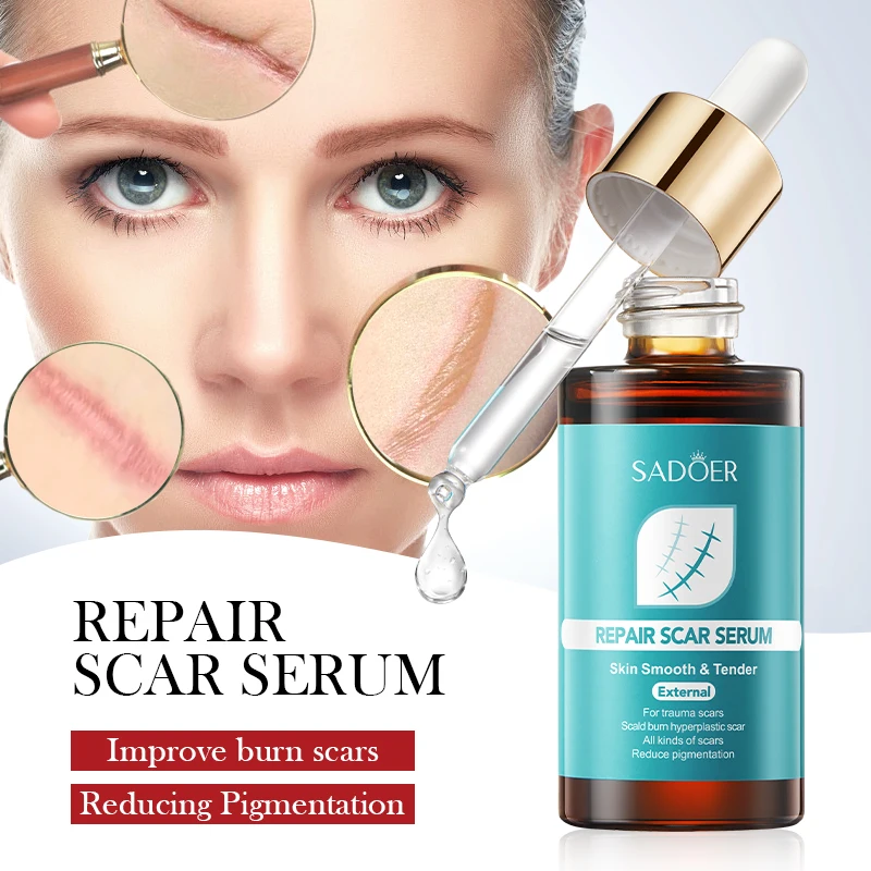 1/2 Piece Scar Repair Serum to Reduce Swelling and Pigmentation, Centella Asiatica Anti-Inflammatory to Promote Wound Healing, Multiple Plant Extracts to Reduce Pigmentation, Soften and Repair Scars, Improve Burn Scars
1/2 Piece Scar Repair Serum to Reduce Swelling and Pigmentation, Centella Asiatica Anti-Inflammatory to Promote Wound Healing, Multiple Plant Extracts to Reduce Pigmentation, Soften and Repair Scars, Improve Burn Scars