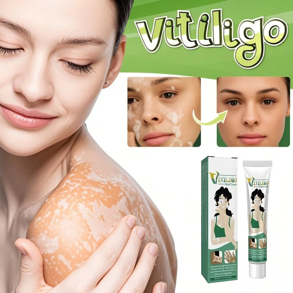 Vitiligo Removal Cream White Spot Care Cream Skincare cream vitiligo skin Sweat spot Reduce white spots
Vitiligo Removal Cream White Spot Care Cream Skincare cream vitiligo skin Sweat spot Reduce white spots