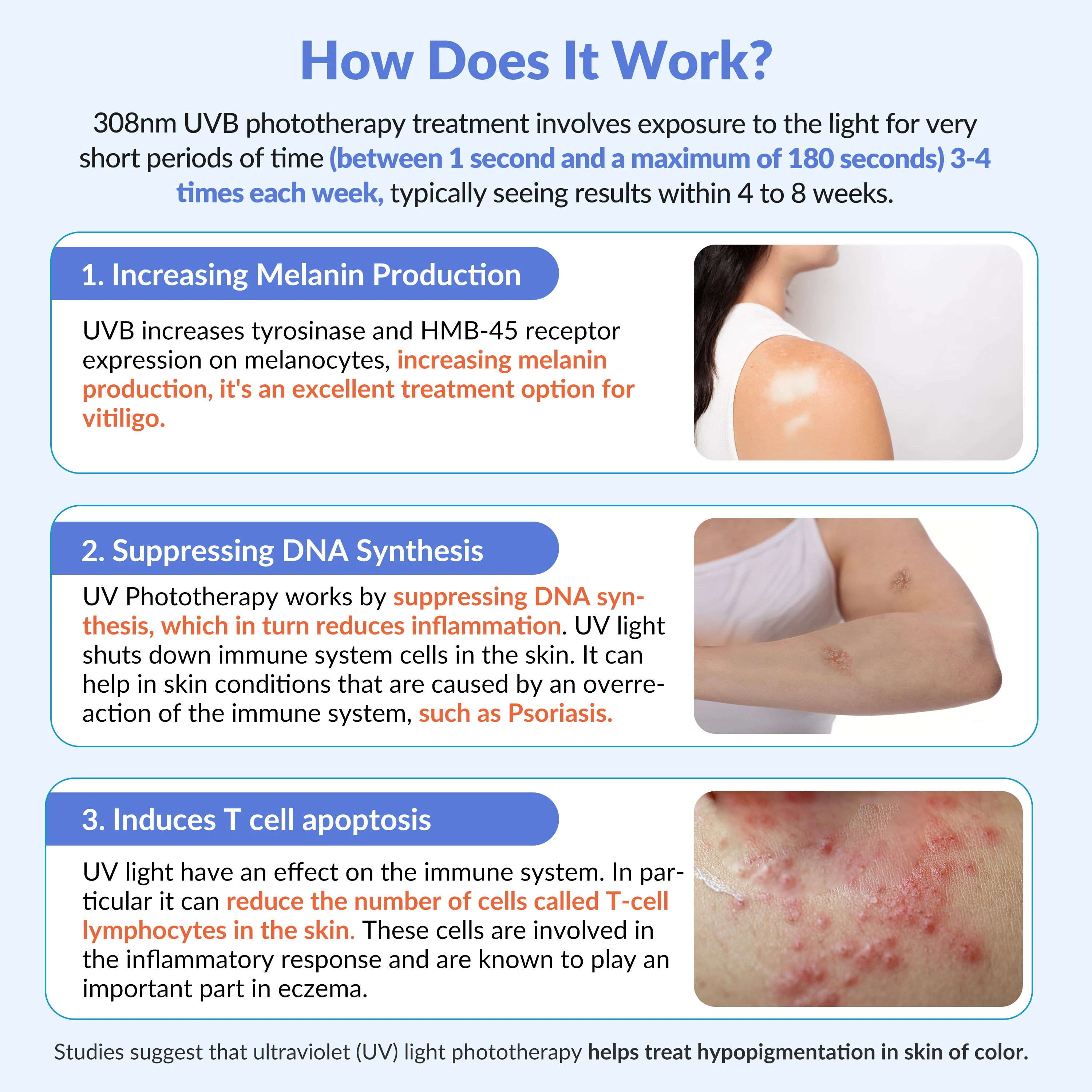 New308nm Excimer UVB Phototherapy Lamp for Vitiligo Treatment Eczema Skin Care and Medical UV Therapy
New308nm Excimer UVB Phototherapy Lamp for Vitiligo Treatment Eczema Skin Care and Medical UV Therapy