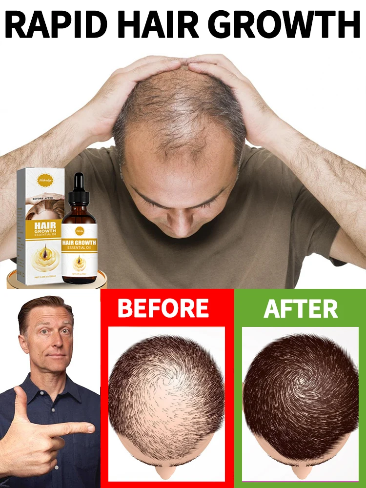 little brown bottle hair growth essential 0iI. Say goodbye to baIdness. The secret 0f thick hair hair growth serums
little brown bottle hair growth essential 0iI. Say goodbye to baIdness. The secret 0f thick hair hair growth serums