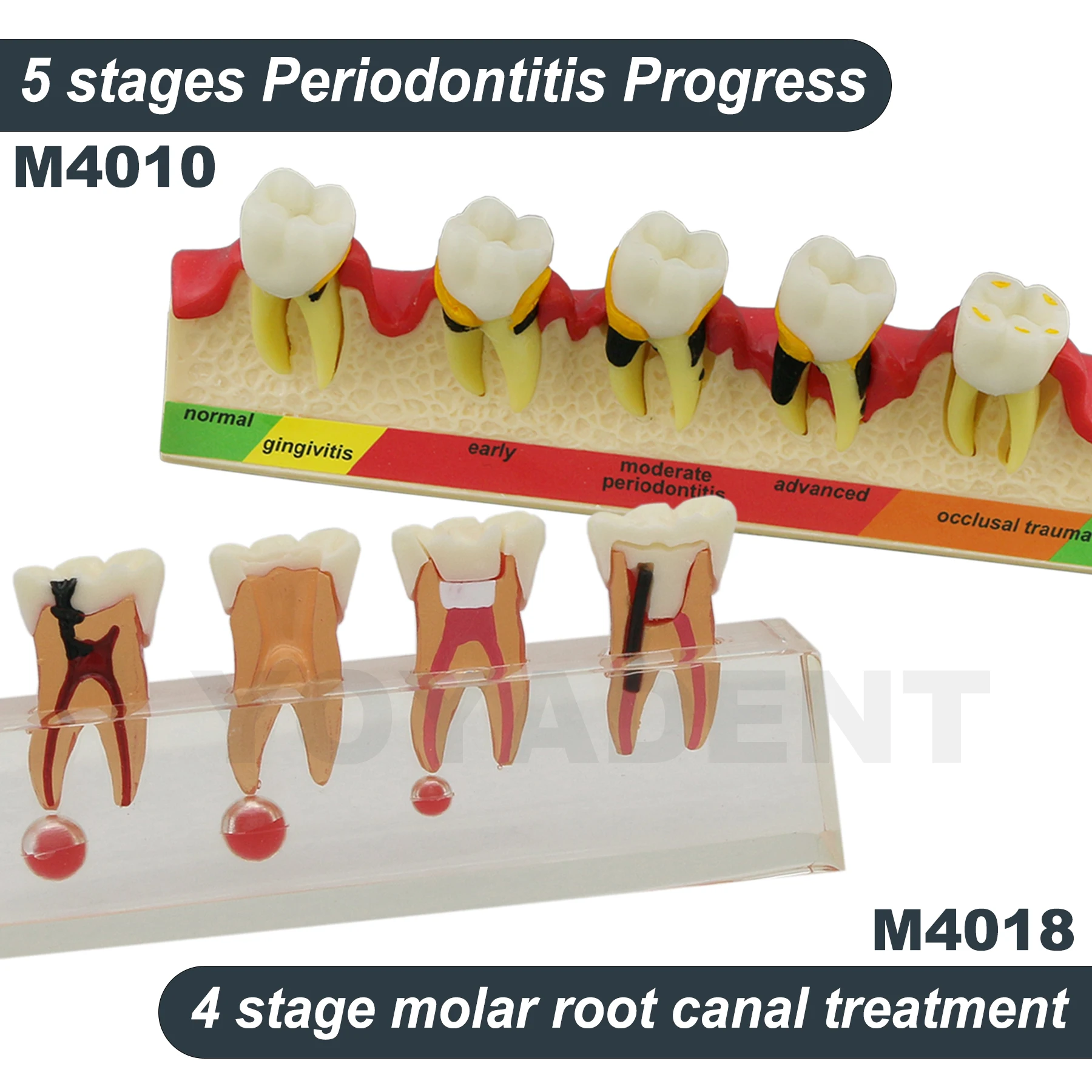 Dental Teeth Model 4-Stages Endodontic 5 Stages Periodontal Disease Teaching Model For Patient Education Demo
Dental Teeth Model 4-Stages Endodontic 5 Stages Periodontal Disease Teaching Model For Patient Education Demo