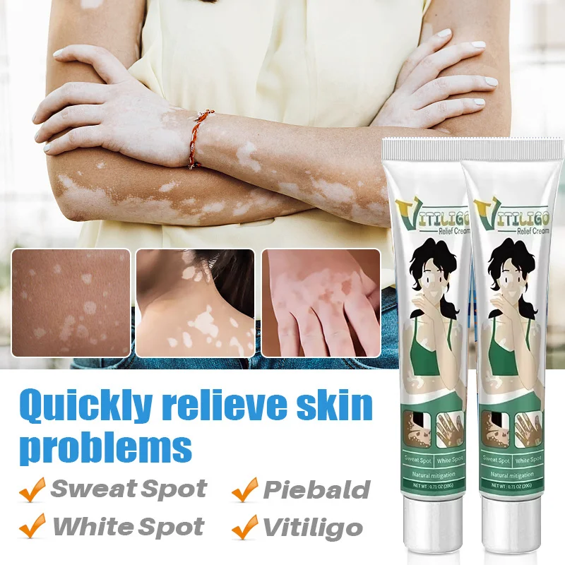 Vitiligo Cream Natural Relief Skin Treatment Soothing White Spot Removal Vitiligo Cream Eliminate Pigment remove white patches
Vitiligo Cream Natural Relief Skin Treatment Soothing White Spot Removal Vitiligo Cream Eliminate Pigment remove white patches