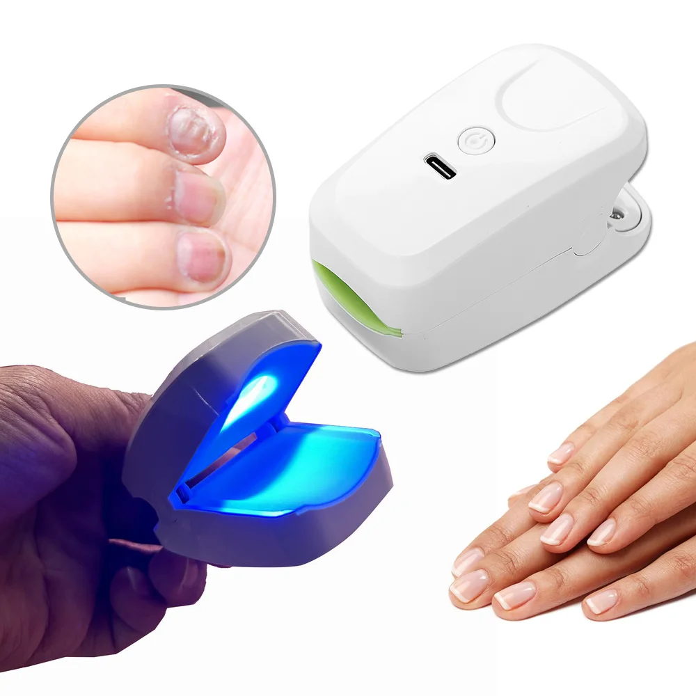 905NM лазерное устройство для лечения ногтей с грибком, зарядка через USB, светотерапия для ногтей, ногтей на ногах, машина для лечения онихомикоза 
905NM лазерное устройство для лечения ногтей с грибком, зарядка через USB, светотерапия для ногтей, ногтей на ногах, машина для лечения онихомикоза