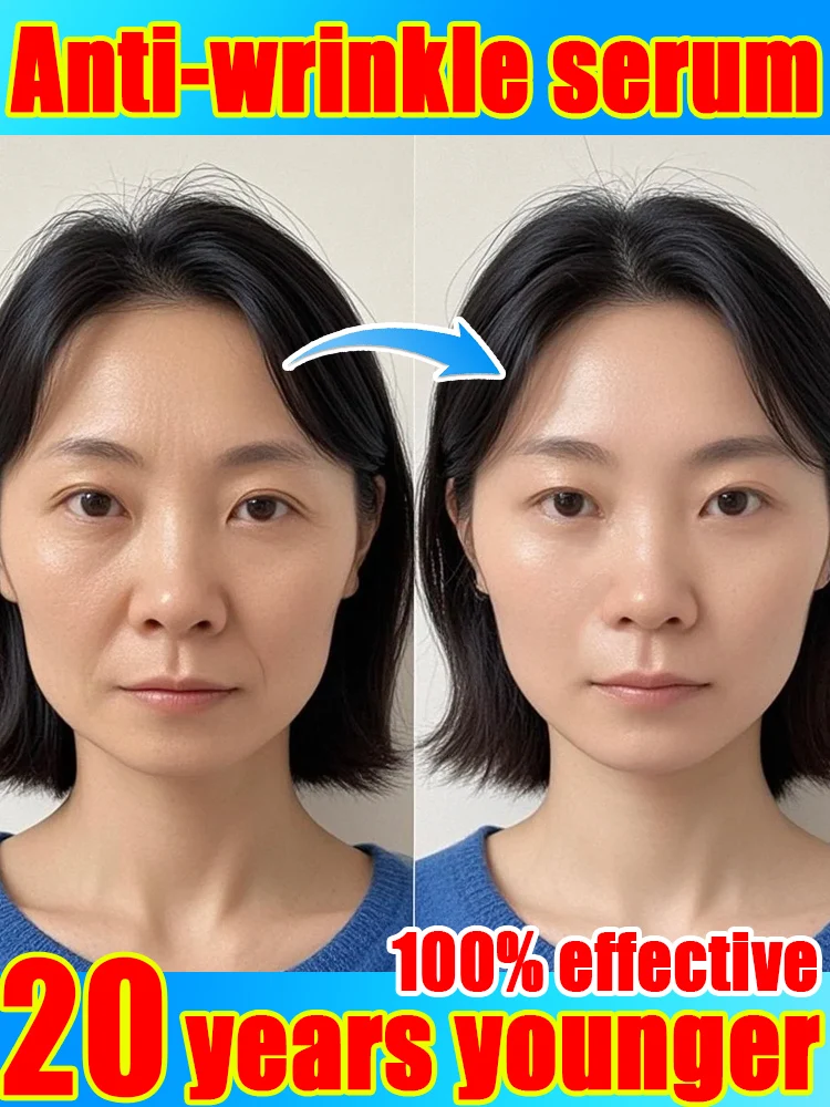 Anti-aging essence, anti-aging essential oil, anti-wrinkle, firming, loosening, reducing skin, fine lines
Anti-aging essence, anti-aging essential oil, anti-wrinkle, firming, loosening, reducing skin, fine lines