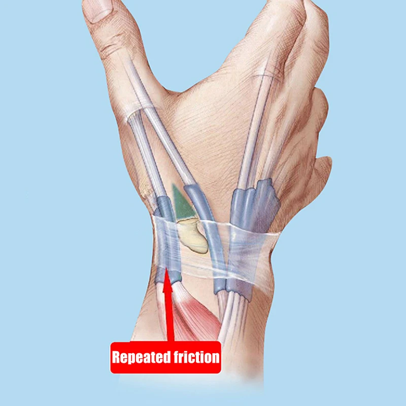New 1Pc Thumb Brace Wrist Stabilizer Pain Relief Right Or Left Hand Soft Thumb Support Compression Sleeve Protector
New 1Pc Thumb Brace Wrist Stabilizer Pain Relief Right Or Left Hand Soft Thumb Support Compression Sleeve Protector