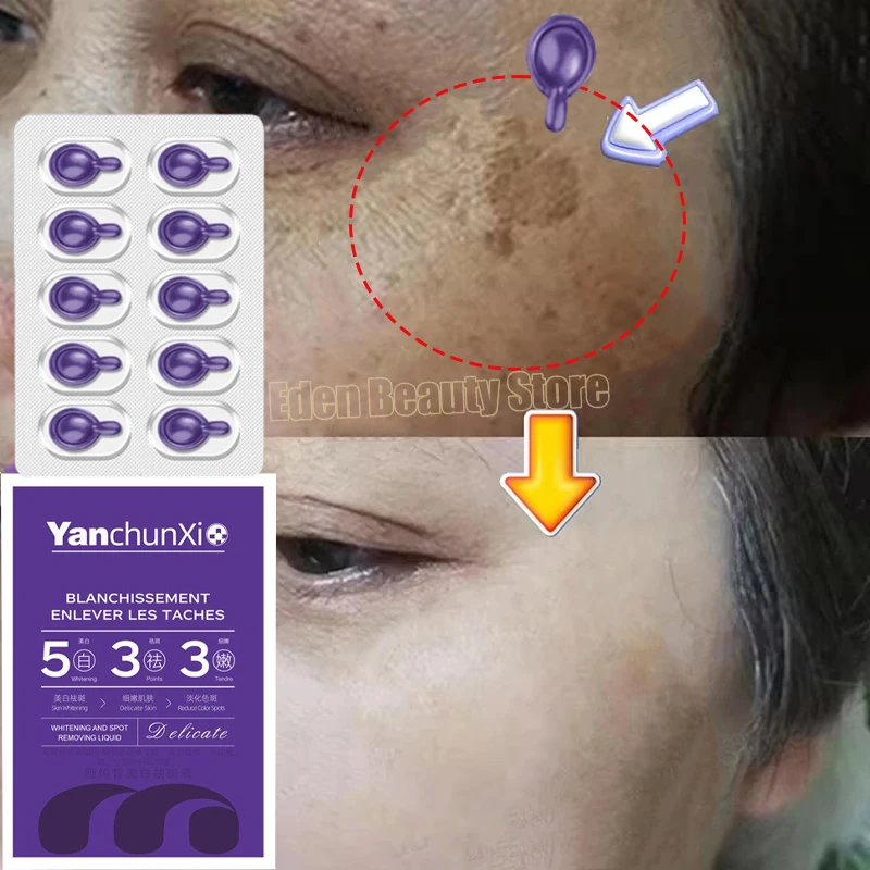 Dark Spots Remover Whitening Serum Face Freckle Melanin Correcting Anti Pigmentation Brighten Beauty Korean Day Night Skin Care
Dark Spots Remover Whitening Serum Face Freckle Melanin Correcting Anti Pigmentation Brighten Beauty Korean Day Night Skin Care