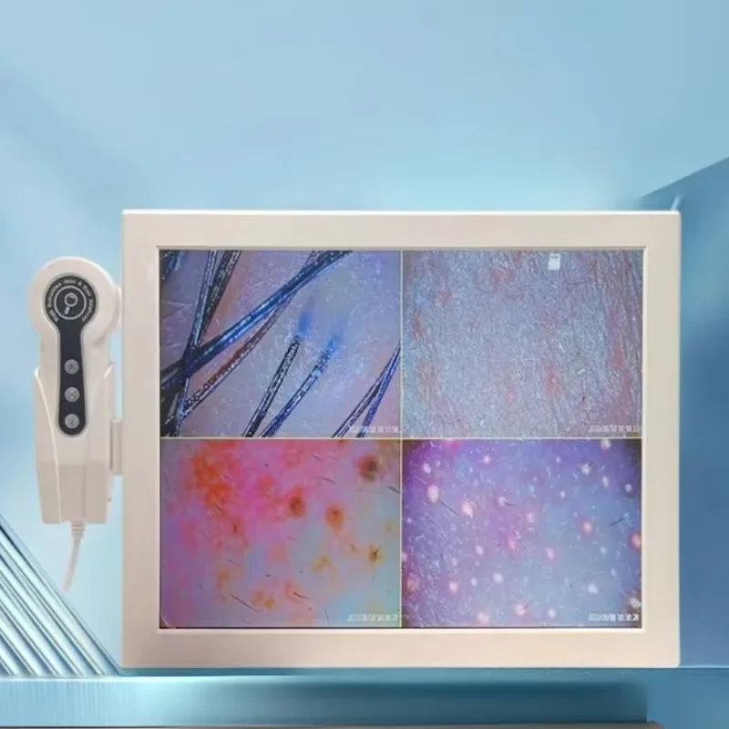 15 inch digital high definition screen, home skin and hair analyzer to help you analyze skin
15 inch digital high definition screen, home skin and hair analyzer to help you analyze skin