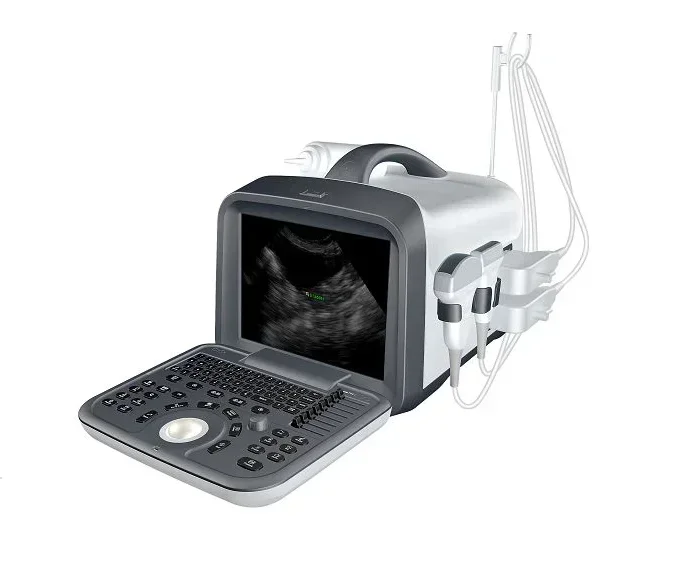 Portable B/W ultrasound machine ZQ-6602 MEDICAL Veterinary Ultrasound Full Digital vet Ultrasound SCANNING SYSTEM FOR HOSPITAL
Portable B/W ultrasound machine ZQ-6602 MEDICAL Veterinary Ultrasound Full Digital vet Ultrasound SCANNING SYSTEM FOR HOSPITAL