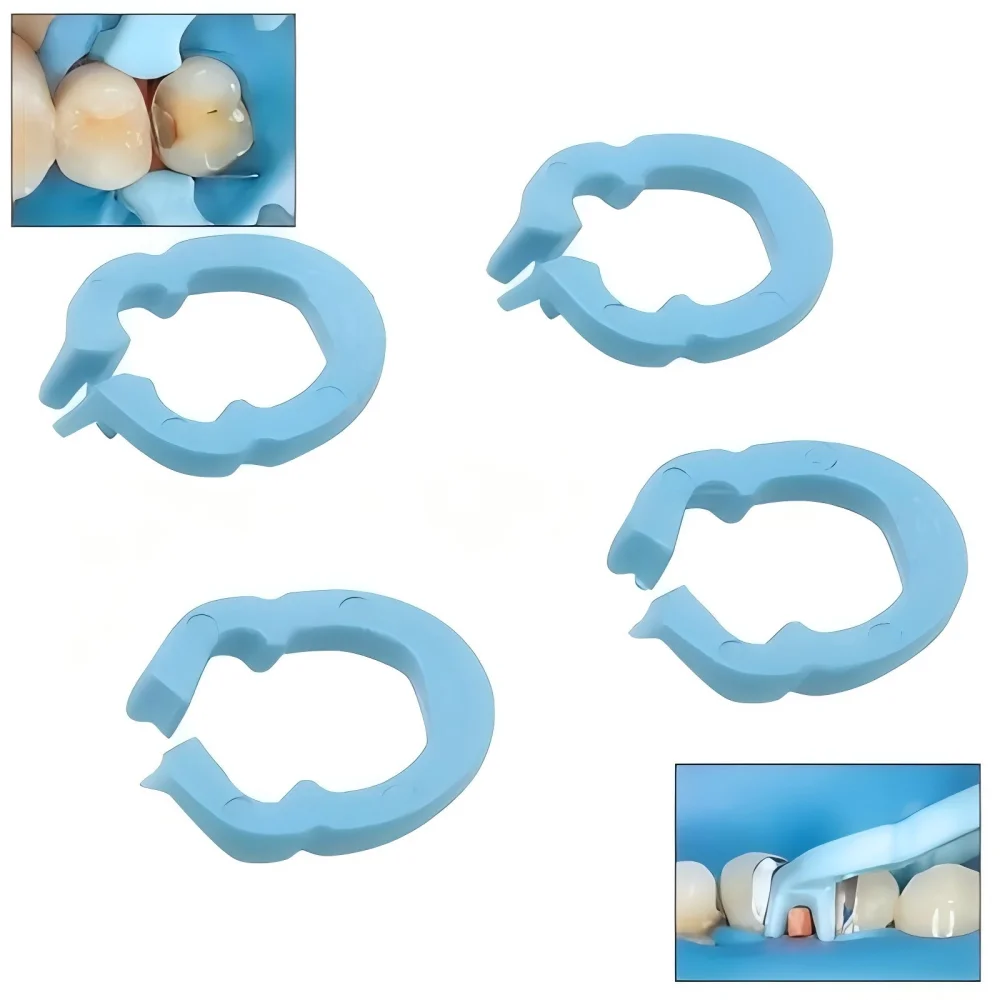 4Pcs/Box Dental Resin Clamping Ring Rubber Dam Clips Autoclavable 134°C Barrier Separator Matrix Fixation Clip Dentist Tools
4Pcs/Box Dental Resin Clamping Ring Rubber Dam Clips Autoclavable 134°C Barrier Separator Matrix Fixation Clip Dentist Tools