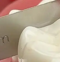 1Pcs Dental Interproximal Reduction Gauge Ruler Orthodontic Treatment Tools Ipr Tooth Gap Orthodontic Measuring Ruler
1Pcs Dental Interproximal Reduction Gauge Ruler Orthodontic Treatment Tools Ipr Tooth Gap Orthodontic Measuring Ruler