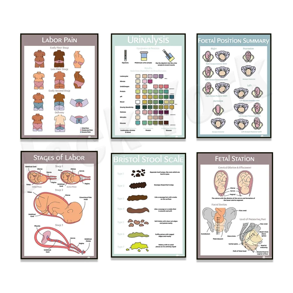 Stages of Labor / Labor Poster, Urinalysis, Fetal Head Position, Bristol Stool Scale, Capstone Presentation Educational Poster
Stages of Labor / Labor Poster, Urinalysis, Fetal Head Position, Bristol Stool Scale, Capstone Presentation Educational Poster