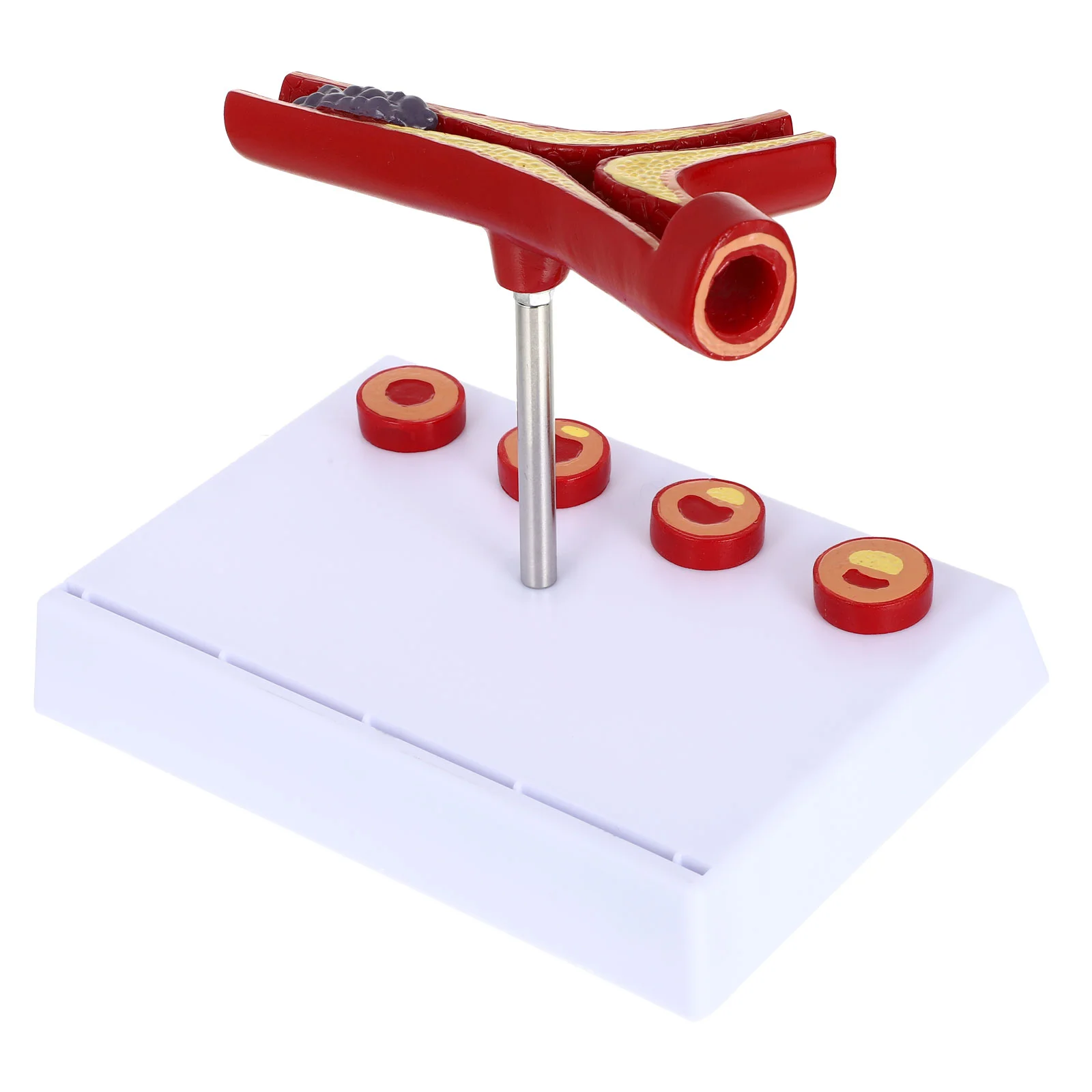 Vascular Model Atherosclerosis Head Cardiovascular Body Pvc Display Hospital Human Anatomical Models
Vascular Model Atherosclerosis Head Cardiovascular Body Pvc Display Hospital Human Anatomical Models