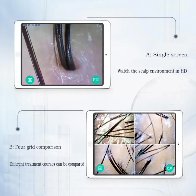 F62C Wireless Scalp with HDImage Hair Follicle Scalp Detector WIFI for Hair Salons and Beauty Chains
F62C Wireless Scalp with HDImage Hair Follicle Scalp Detector WIFI for Hair Salons and Beauty Chains
