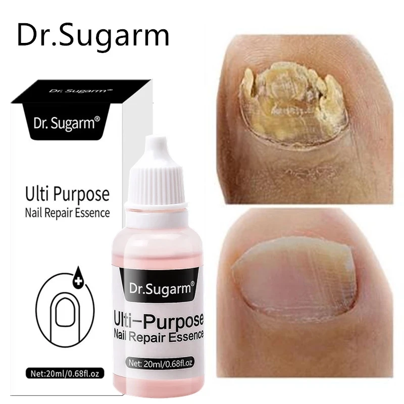 Средство для лечения Ногтей от грибков Dr.Sugarm, сыворотка для лечения паронихии, антиинфекционный грибок для пальцев, ног, рук, онихомикоз, удаление, восстанавливание, красота, здоровье
Средство для лечения Ногтей от грибков Dr.Sugarm, сыворотка для лечения паронихии, антиинфекционный грибок для пальцев, ног, рук, онихомикоз, удаление, восстанавливание, красота, здоровье