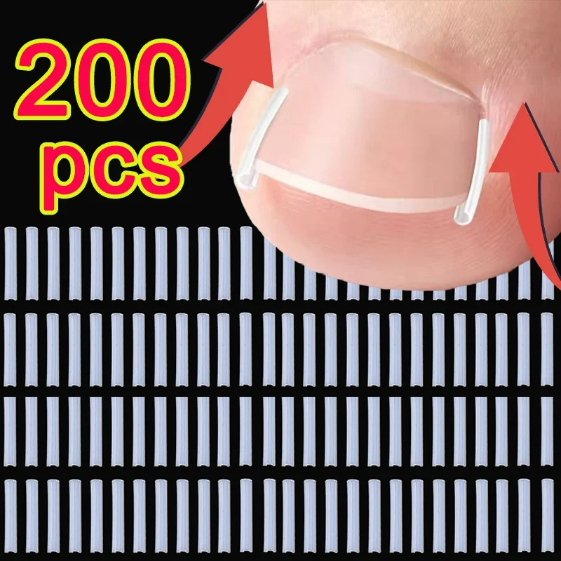 Ultra-thin Ingrown Toenail Corrector Tools C-shaped Tube Pad Correcting Nails Growth Paronychia Treatment Recover Pedicure Tools
Ultra-thin Ingrown Toenail Corrector Tools C-shaped Tube Pad Correcting Nails Growth Paronychia Treatment Recover Pedicure Tools