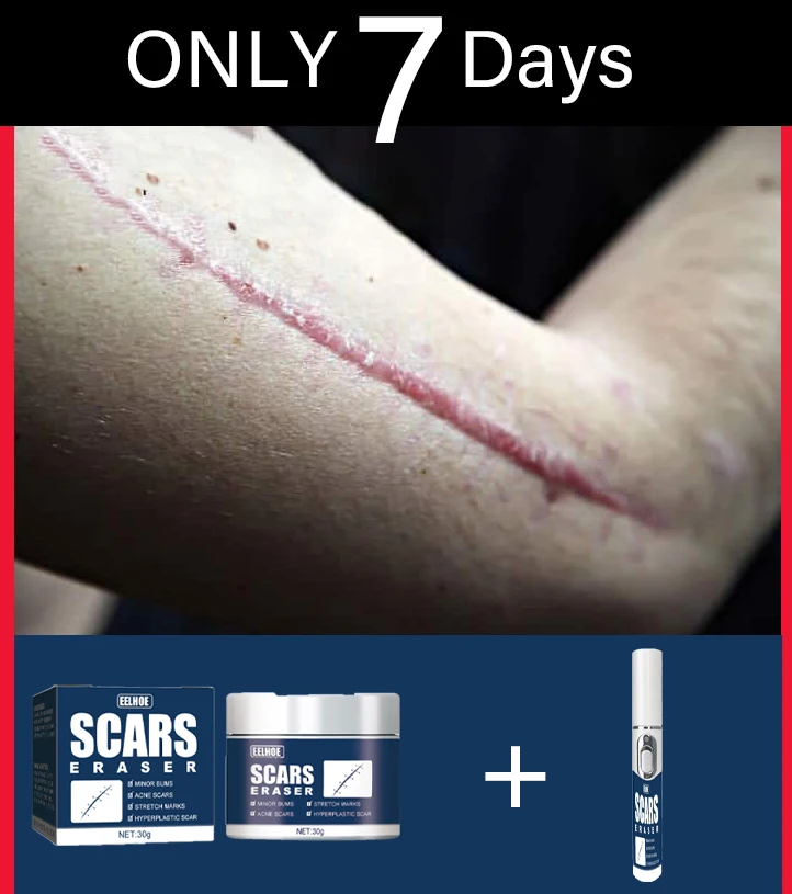 Reduce the Appearance of Scars with Our Portable Laser Pen
Reduce the Appearance of Scars with Our Portable Laser Pen