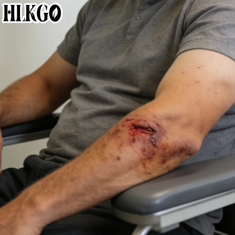 Лучший лазер с двойной длиной волны 1055 мВт и сенсорным экраном, 650 нм 808 нм, для физиотерапии LLLT, облегчения восстановления после растяжений плеча
Лучший лазер с двойной длиной волны 1055 мВт и сенсорным экраном, 650 нм 808 нм, для физиотерапии LLLT, облегчения восстановления после растяжений плеча