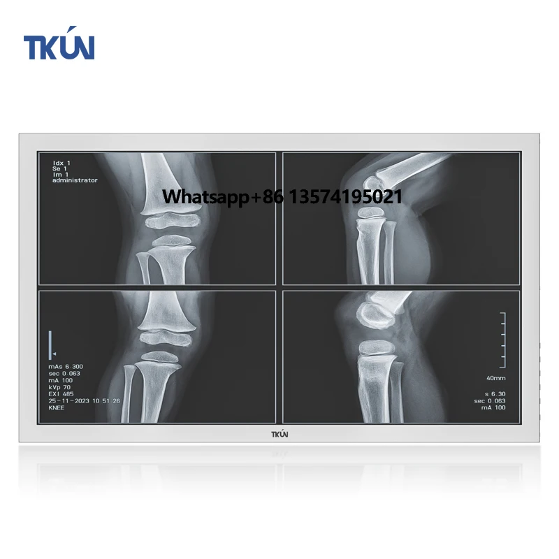 2mp Medical Imaging Display 27 Inch Medical Device LCD/LED BNC Screen Display with 3G-SDI DVI HD VGA
2mp Medical Imaging Display 27 Inch Medical Device LCD/LED BNC Screen Display with 3G-SDI DVI HD VGA