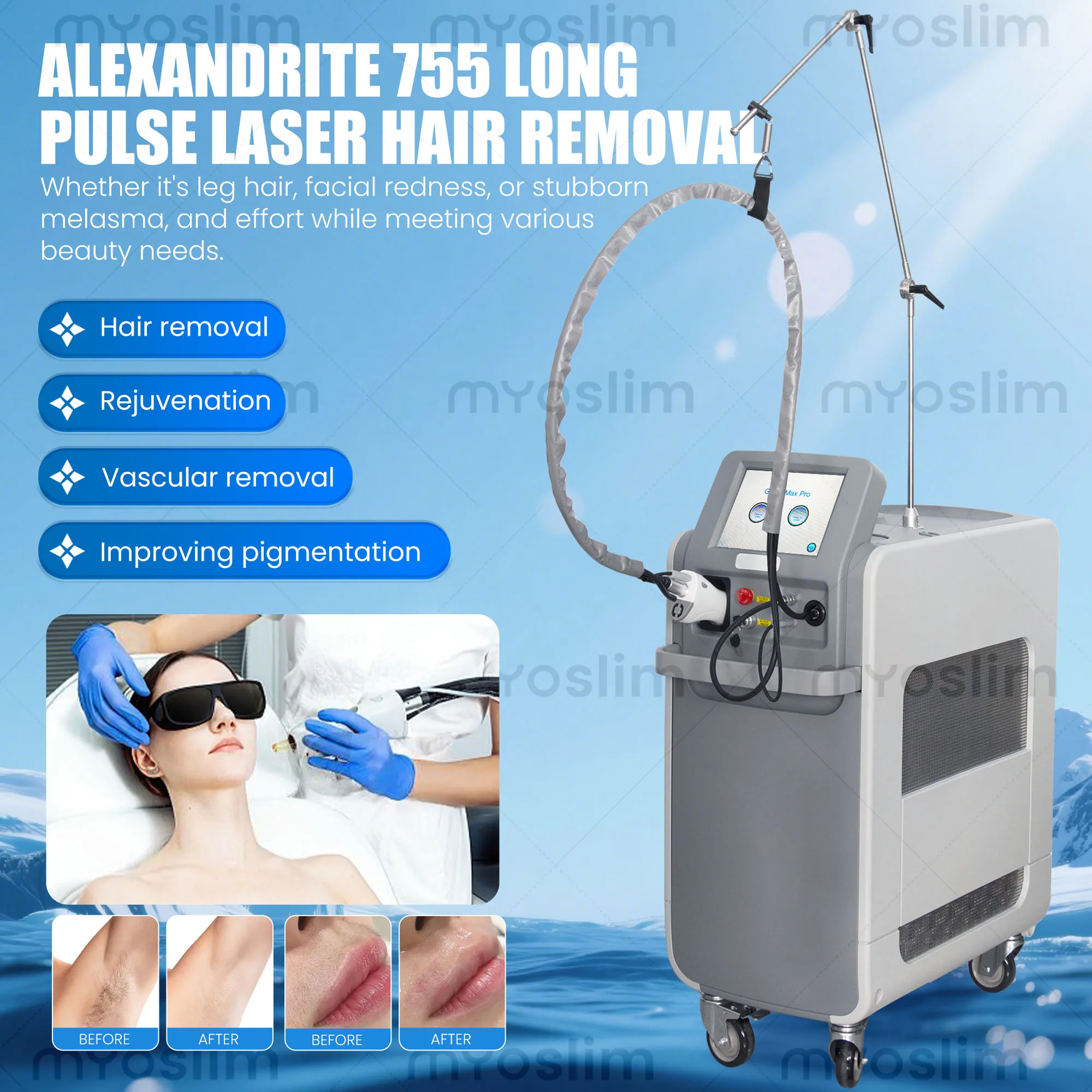 Rejuvenation Beauty Equipment Alexandrite 755nm Long Pulse Hair Removal Instrument 1064nm Fiber Optic Skin
Rejuvenation Beauty Equipment Alexandrite 755nm Long Pulse Hair Removal Instrument 1064nm Fiber Optic Skin
