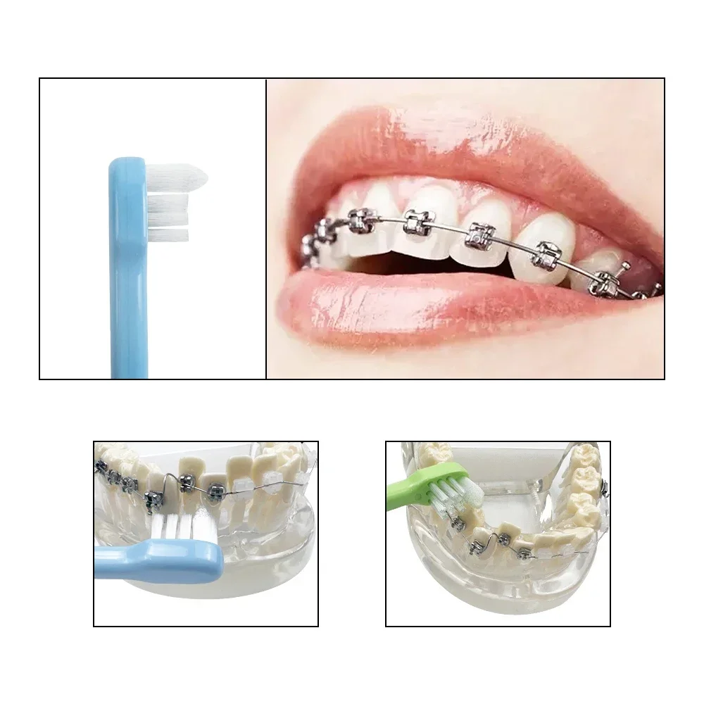 50pcs Dental Orthodontic Toothbrush Braces Interdental Brushes For Teeth Small Head End Tapered Tooth Brush Oral Care Cleaning
50pcs Dental Orthodontic Toothbrush Braces Interdental Brushes For Teeth Small Head End Tapered Tooth Brush Oral Care Cleaning