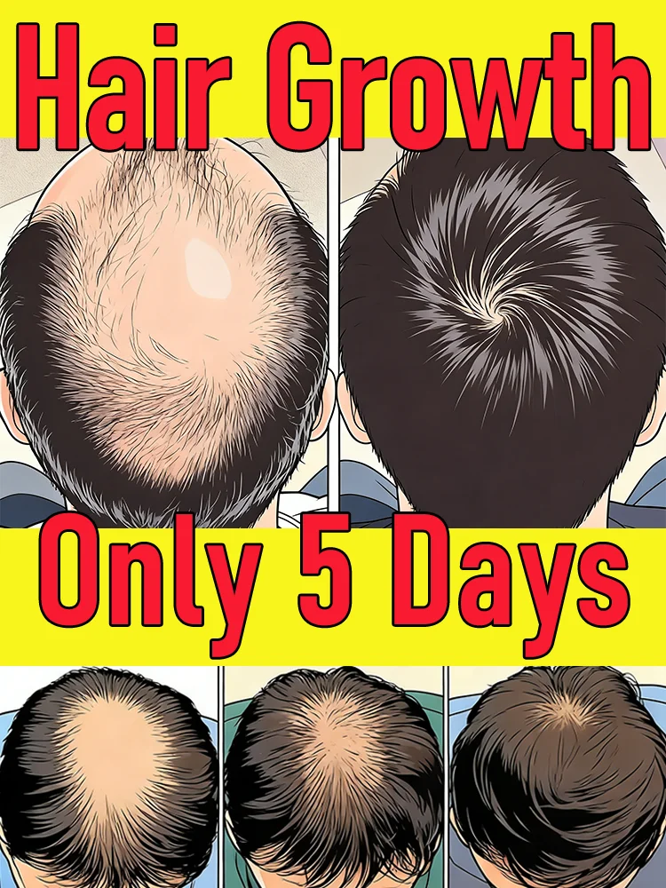 Nourish hair roots to create healthy hair and silky, voluminous hair.No side effects,unisex
Nourish hair roots to create healthy hair and silky, voluminous hair.No side effects,unisex