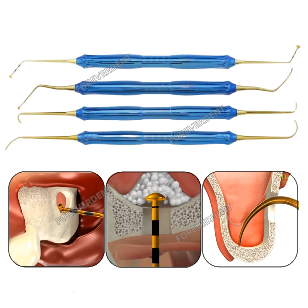 Dental DASK Dome Handle Sinus Lift Release Membrane Elevator Crestal Approach Multi/Mini Curve Hoke Shape Lifting
Dental DASK Dome Handle Sinus Lift Release Membrane Elevator Crestal Approach Multi/Mini Curve Hoke Shape Lifting