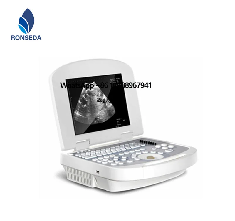 Hospital Multi Parameters Veterinary Ultrasound Scanner 
Hospital Multi Parameters Veterinary Ultrasound Scanner