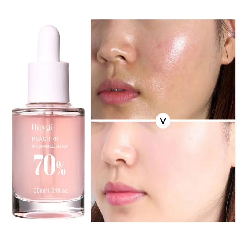 70% Niacinamide Whitening Serum Dark Spots Remover Freckle Face Essence Moisturizing Brighten Nourish Firming SkinCare
70% Niacinamide Whitening Serum Dark Spots Remover Freckle Face Essence Moisturizing Brighten Nourish Firming SkinCare
