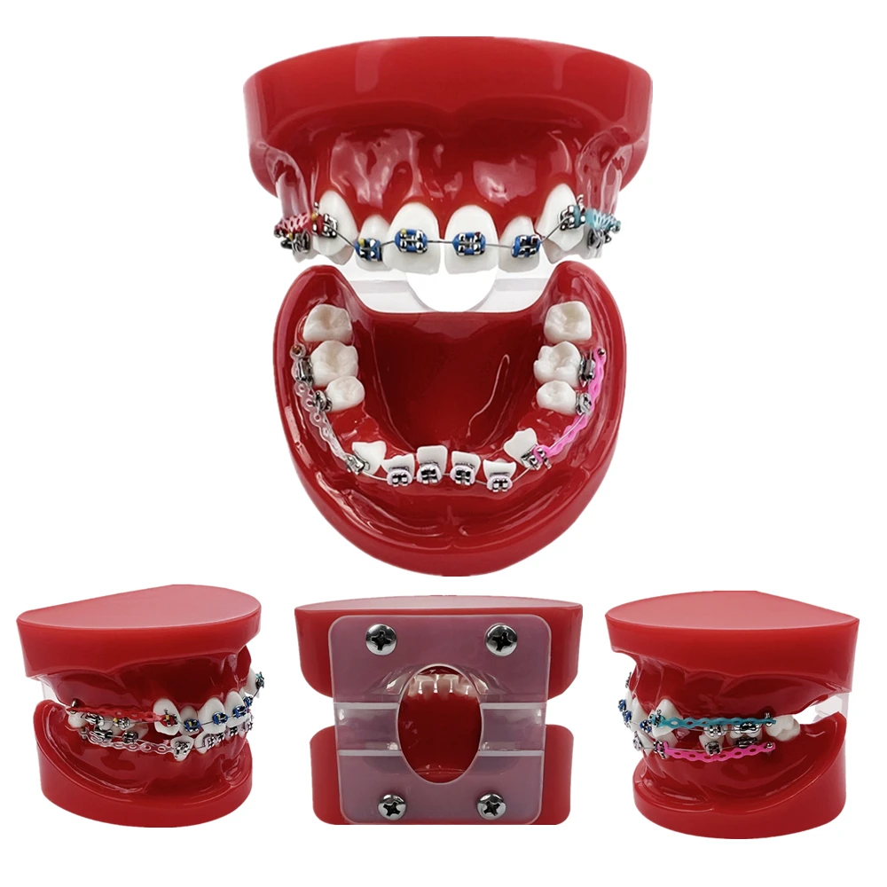 Orthodontic Dental Teeth Model With All Metal Bracket Ortho Model For Teaching Education Display Dentist-Patient Communication
Orthodontic Dental Teeth Model With All Metal Bracket Ortho Model For Teaching Education Display Dentist-Patient Communication