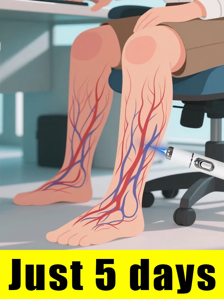 Convenient tools for treating venous abnormalities, laser technology
Convenient tools for treating venous abnormalities, laser technology