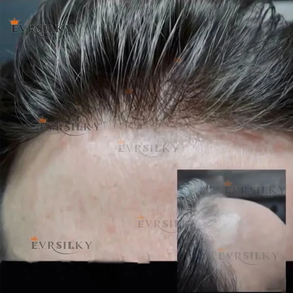 80Density Light Weight #365#440 Micro Thin Skin Base 0.02mm Man's Wig Natural Hairline 100% Human Hair Capillary Prosthes System
80Density Light Weight #365#440 Micro Thin Skin Base 0.02mm Man's Wig Natural Hairline 100% Human Hair Capillary Prosthes System