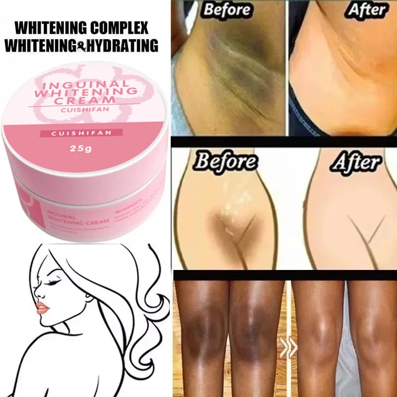 Body Whitening Cream Fast Bleach Private Parts Lighten Underarm Legs Knees Melanin Intimate Areas Remove Dark Spot Beauty Health
Body Whitening Cream Fast Bleach Private Parts Lighten Underarm Legs Knees Melanin Intimate Areas Remove Dark Spot Beauty Health