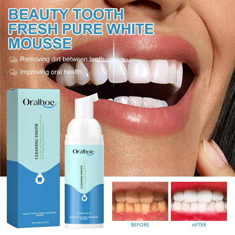 Tooth Cleaning Mousse Toothpaste-Deep Oral Odor Elimination, Stain Removal, Teeth Whitening & Gentle Gum Care for Daily Hygiene
Tooth Cleaning Mousse Toothpaste-Deep Oral Odor Elimination, Stain Removal, Teeth Whitening & Gentle Gum Care for Daily Hygiene