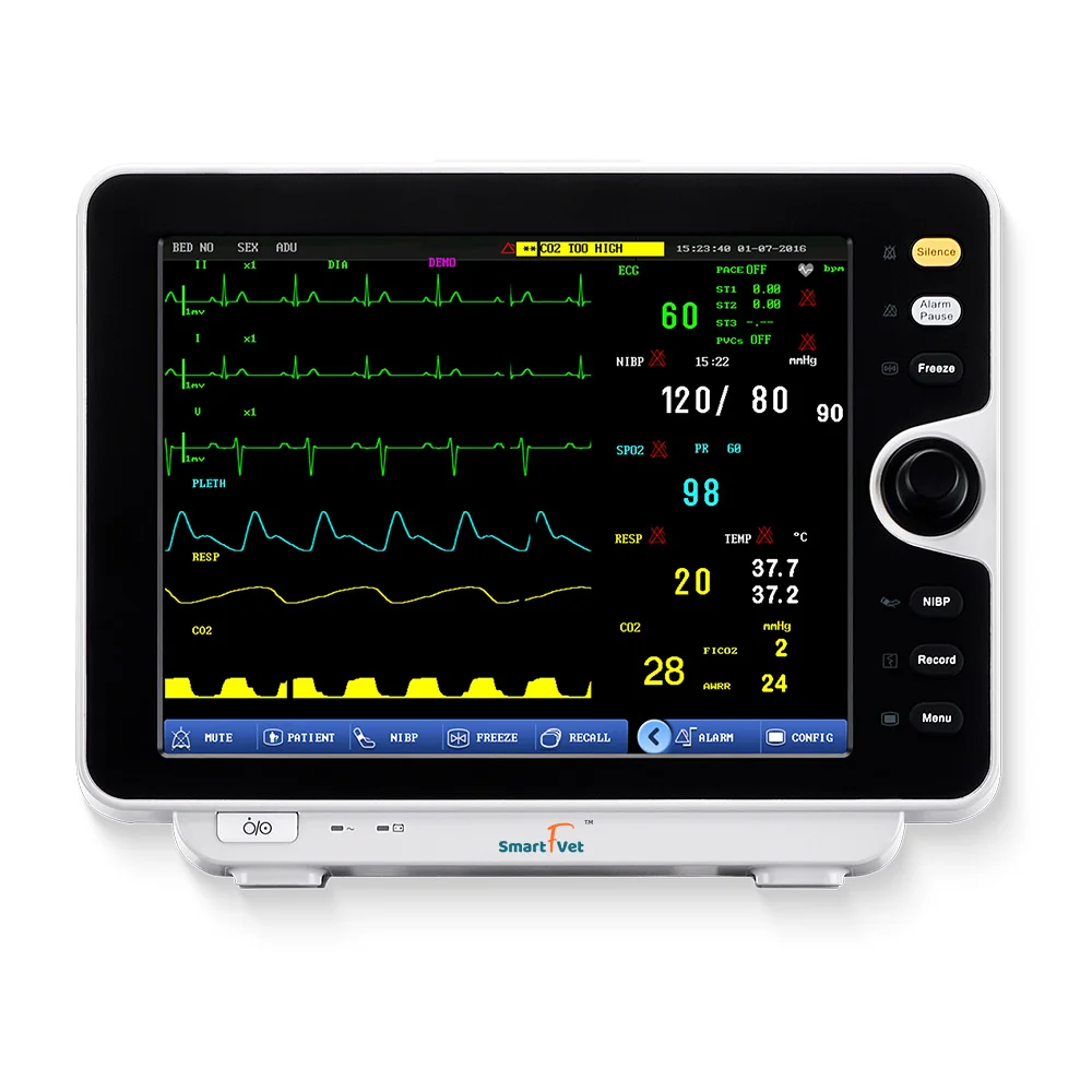Smart F Vet Veterinary Vet Multi-parameter Patient Veterinary Multir 6 Patient for Vet Clinic Use
Smart F Vet Veterinary Vet Multi-parameter Patient Veterinary Multir 6 Patient for Vet Clinic Use
