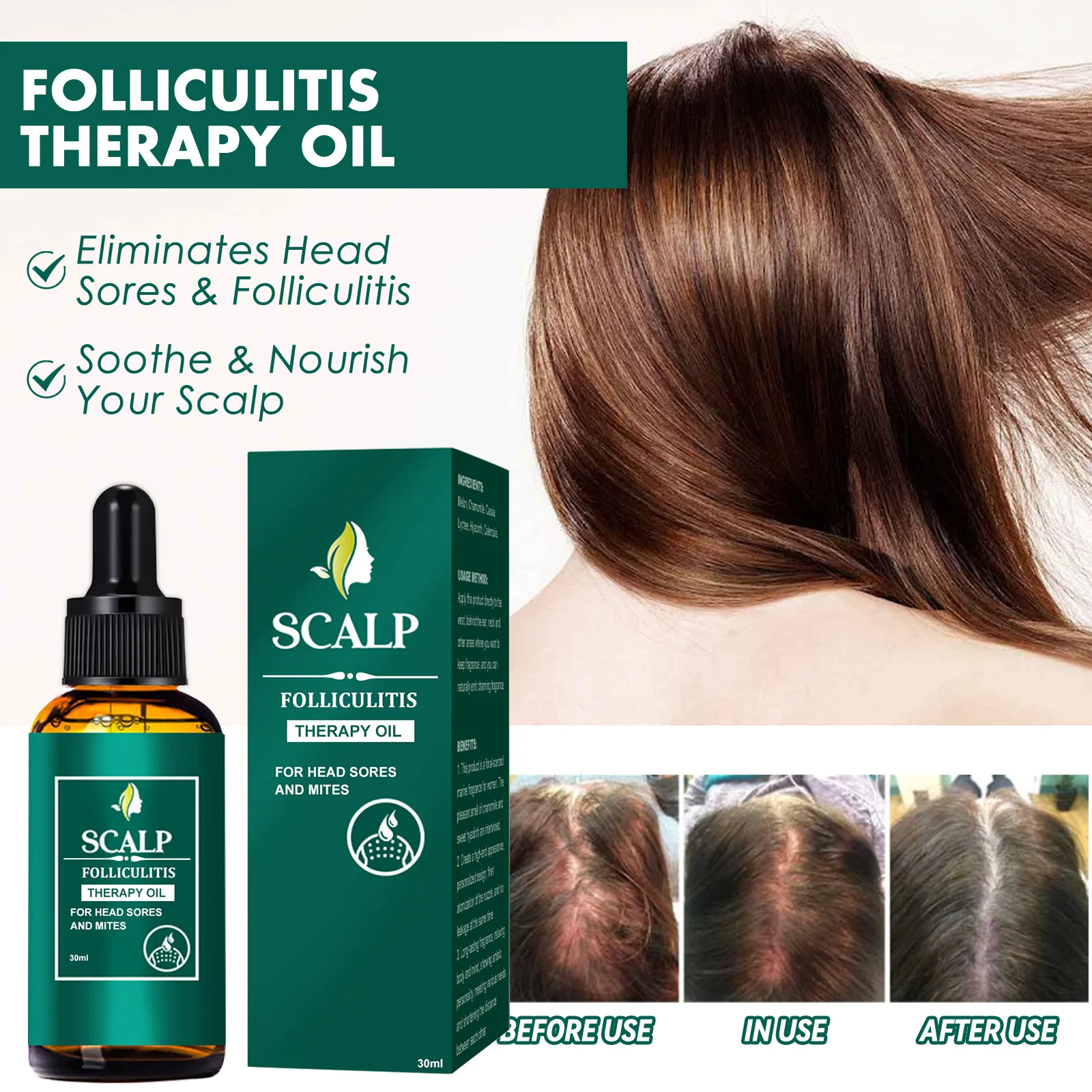 Scalp Treatment Serum Follicles Root Repair Nutritions Hair Anti-Dandruff Promote Hair Fast Growth Essence Oil Beauty Health
Scalp Treatment Serum Follicles Root Repair Nutritions Hair Anti-Dandruff Promote Hair Fast Growth Essence Oil Beauty Health