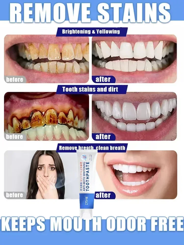 Устраняет зубные бактерии, очищает рот и защитить десны, протеза на зубах, красоту, здоровье, стоматологическая обезologia.
Устраняет зубные бактерии, очищает рот и защитить десны, протеза на зубах, красоту, здоровье, стоматологическая обезologia.