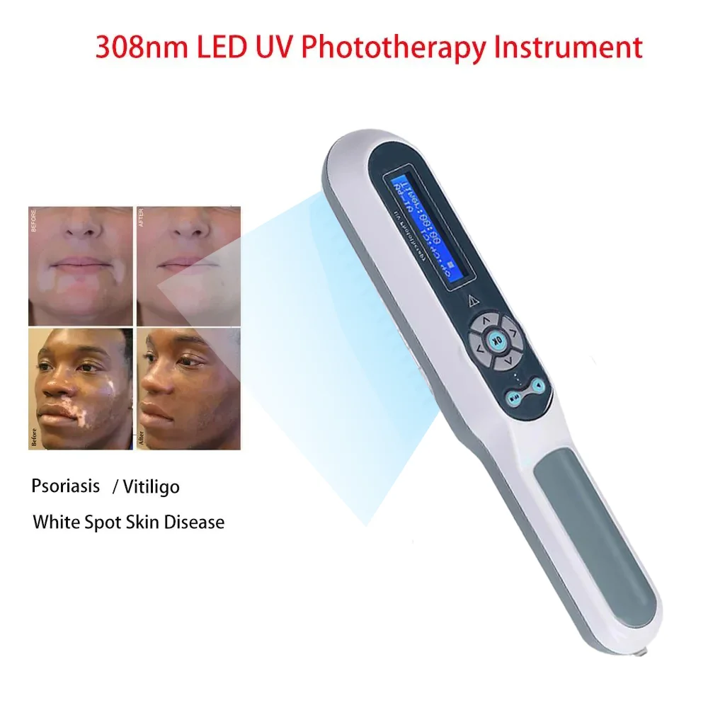 308nm Handheld uvb Light Therapy Portable Effective To Treat vitiligo Psoriasis Eczema Uvb Lamps Uv Phototherapy Instrinstrument
308nm Handheld uvb Light Therapy Portable Effective To Treat vitiligo Psoriasis Eczema Uvb Lamps Uv Phototherapy Instrinstrument