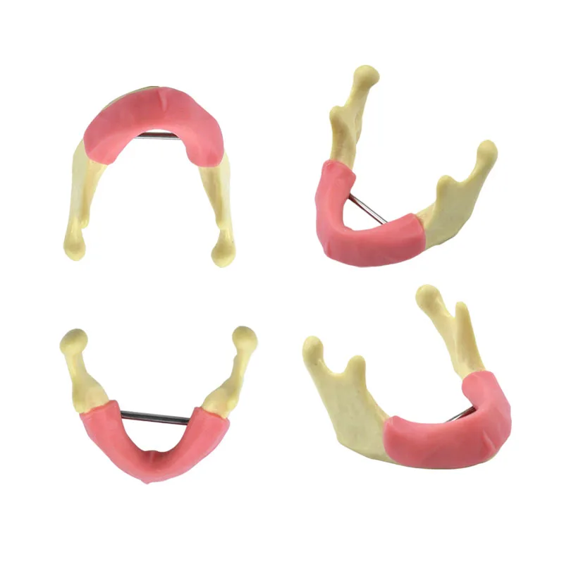 Dental Implant Practice Model with Gum Implant Practice Resin and Cancellous Bone
Dental Implant Practice Model with Gum Implant Practice Resin and Cancellous Bone