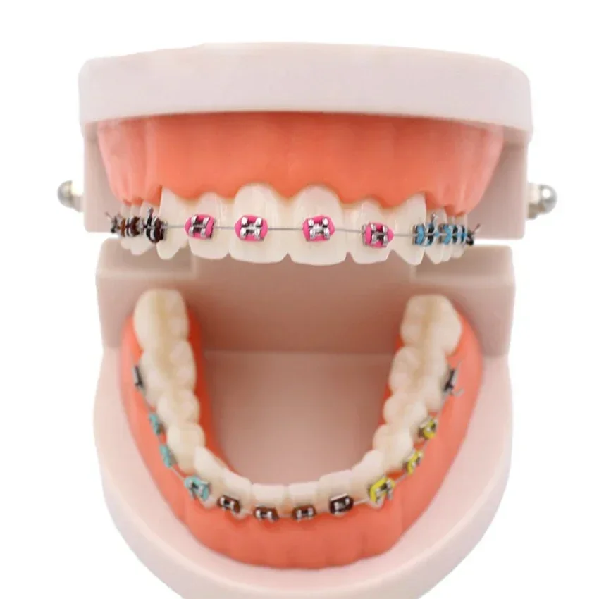 1Pcs Dental Standard Tooth Model with Orthodontic Bracket Wire Buccal Tube Dentisit Studying Teaching Demonstration Tool
1Pcs Dental Standard Tooth Model with Orthodontic Bracket Wire Buccal Tube Dentisit Studying Teaching Demonstration Tool