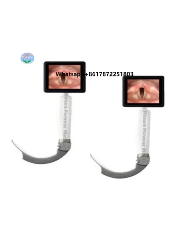 Portable Digital Electronic Laryngoscope Blade Video ENT Medical Equipment Infection-Control Intubation Steel Material Electric
Portable Digital Electronic Laryngoscope Blade Video ENT Medical Equipment Infection-Control Intubation Steel Material Electric