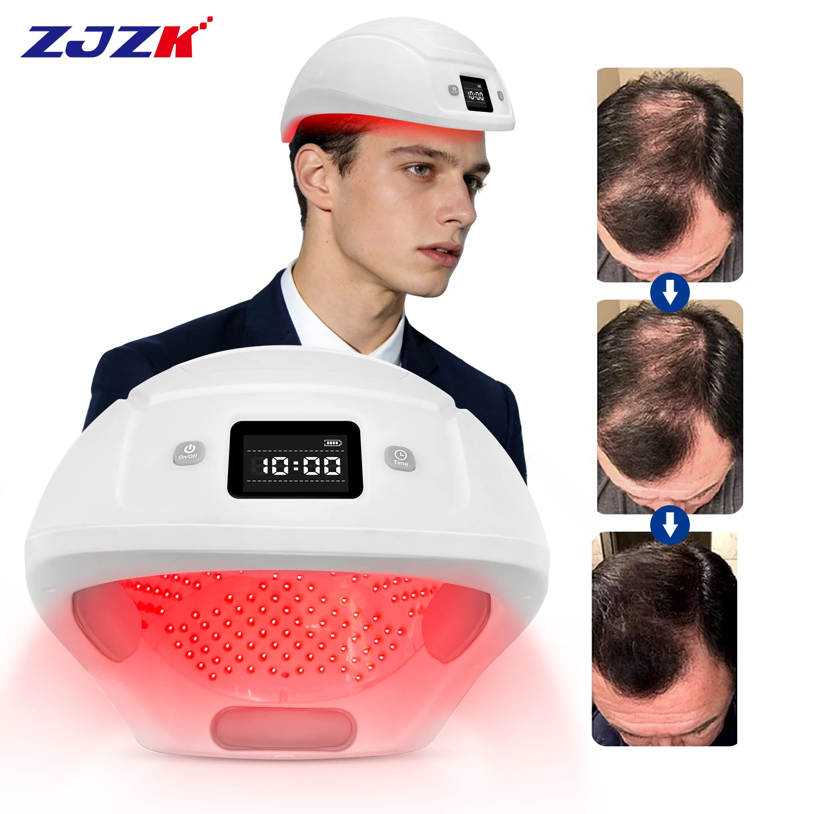 2026 Clinical Grade Red Light Laser Cap Device for Thinning Hair Alopecia Areata and Hair Regrowth Treatment
2026 Clinical Grade Red Light Laser Cap Device for Thinning Hair Alopecia Areata and Hair Regrowth Treatment