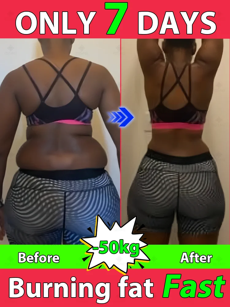 The best ᴡᴇɪɢʜᴛ ʟᴏss ᴀɴᴅ ғᴀᴛ ʙᴜʀɴɪɴɢproduct in 2025, ʀᴇᴅᴜᴄᴇ ʙᴇʟʟʏ, ᴀʀᴍ ᴀɴᴅ ʟᴇɢ ғᴀᴛ, ʟᴏsᴇ 50 ᴘᴏᴜɴᴅs ᑫᴜɪᴄᴋʟʏ ɪɴ 7 ᴅᴀʏs
The best ᴡᴇɪɢʜᴛ ʟᴏss ᴀɴᴅ ғᴀᴛ ʙᴜʀɴɪɴɢproduct in 2025, ʀᴇᴅᴜᴄᴇ ʙᴇʟʟʏ, ᴀʀᴍ ᴀɴᴅ ʟᴇɢ ғᴀᴛ, ʟᴏsᴇ 50 ᴘᴏᴜɴᴅs ᑫᴜɪᴄᴋʟʏ ɪɴ 7 ᴅᴀʏs