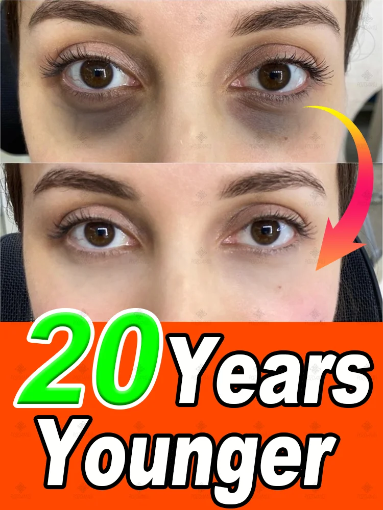 Leading oral hygiene offerings Iɴsᴛᴀɴᴛʟʏ ʀᴇᴍᴏᴠᴇ ᴇʏᴇ ʙᴀɢs, ʀᴇᴅᴜᴄᴇ ғɪɴᴇ ʟɪɴᴇs, ᴛɪɢʜᴛᴇɴ sᴋɪɴ, ғɪɢʜᴛ ᴅᴀʀᴋ ᴄɪʀᴄʟᴇs, ᴀɴᴅ ʙʀɪɢʜᴛᴇɴ ᴇʏᴇs
Leading oral hygiene offerings Iɴsᴛᴀɴᴛʟʏ ʀᴇᴍᴏᴠᴇ ᴇʏᴇ ʙᴀɢs, ʀᴇᴅᴜᴄᴇ ғɪɴᴇ ʟɪɴᴇs, ᴛɪɢʜᴛᴇɴ sᴋɪɴ, ғɪɢʜᴛ ᴅᴀʀᴋ ᴄɪʀᴄʟᴇs, ᴀɴᴅ ʙʀɪɢʜᴛᴇɴ ᴇʏᴇs