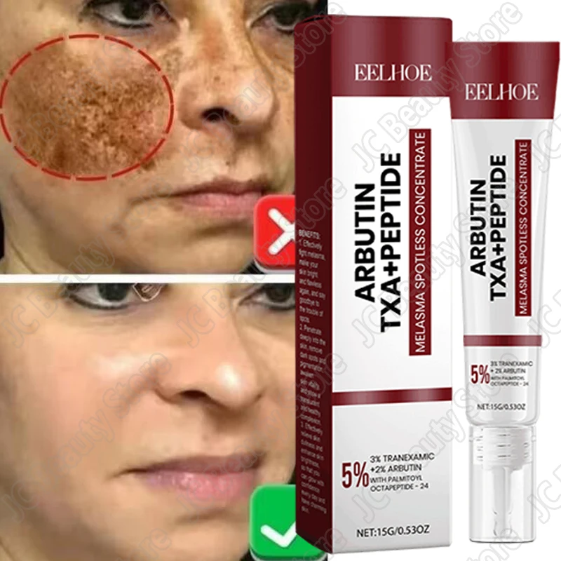 Whitening Freckle Cream Melasma Dark Spots Pigmentation Removal Products Fade Stain Melanin Repair Brighten Korean Skin Care
Whitening Freckle Cream Melasma Dark Spots Pigmentation Removal Products Fade Stain Melanin Repair Brighten Korean Skin Care