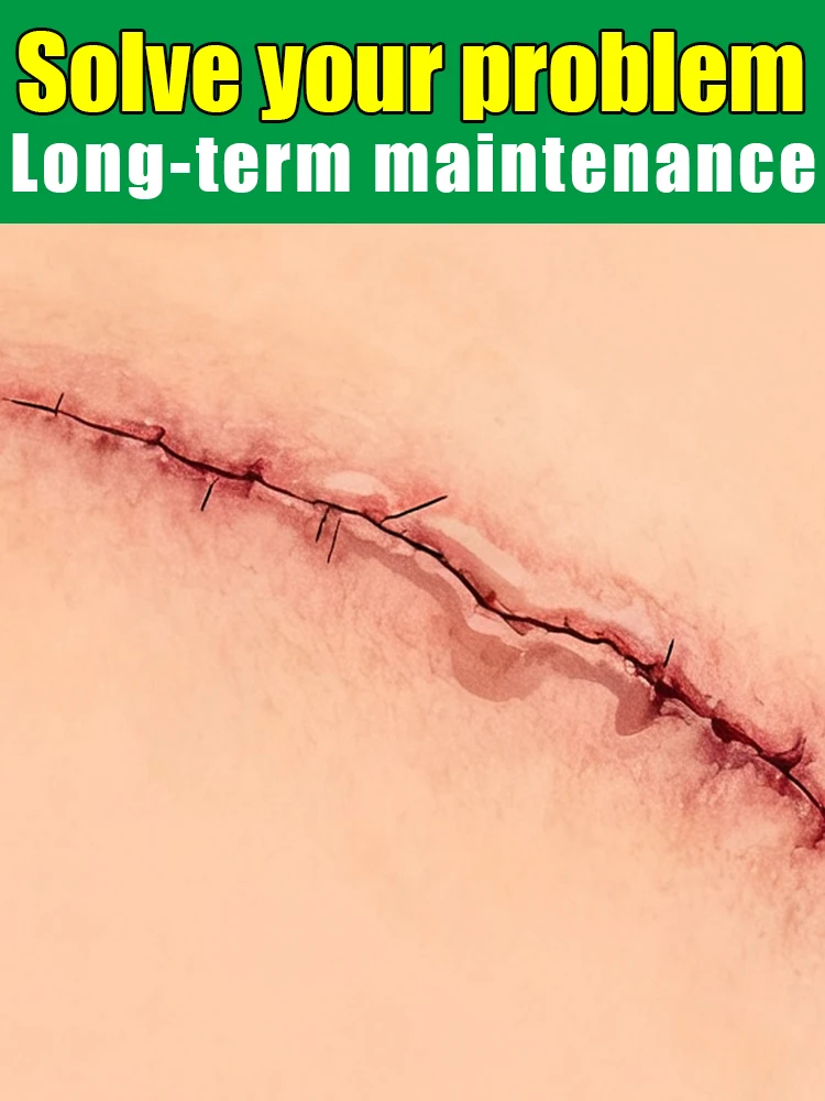 2026new generation laser pens to solve your scar problems and keep your skin healthy free shipping
2026new generation laser pens to solve your scar problems and keep your skin healthy free shipping