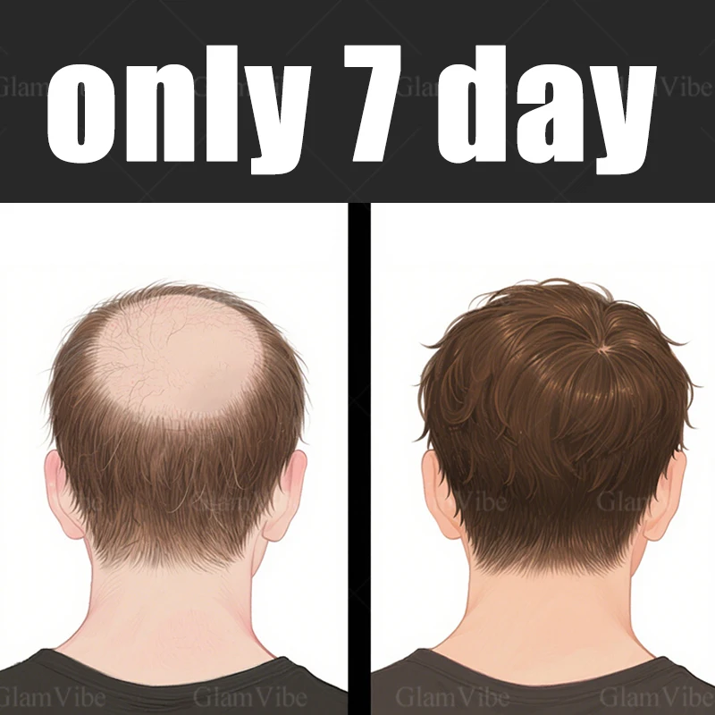 Нежное проникновение без раздражения, специальная цена и супер экономичное. 
Нежное проникновение без раздражения, специальная цена и супер экономичное.