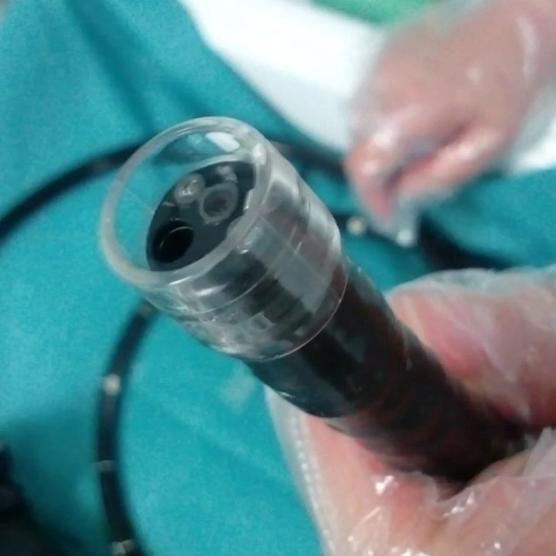 5pcs/lot Disposable Endoscopic Far-end Caps Gastroenteroscopy Transparent Cap
5pcs/lot Disposable Endoscopic Far-end Caps Gastroenteroscopy Transparent Cap