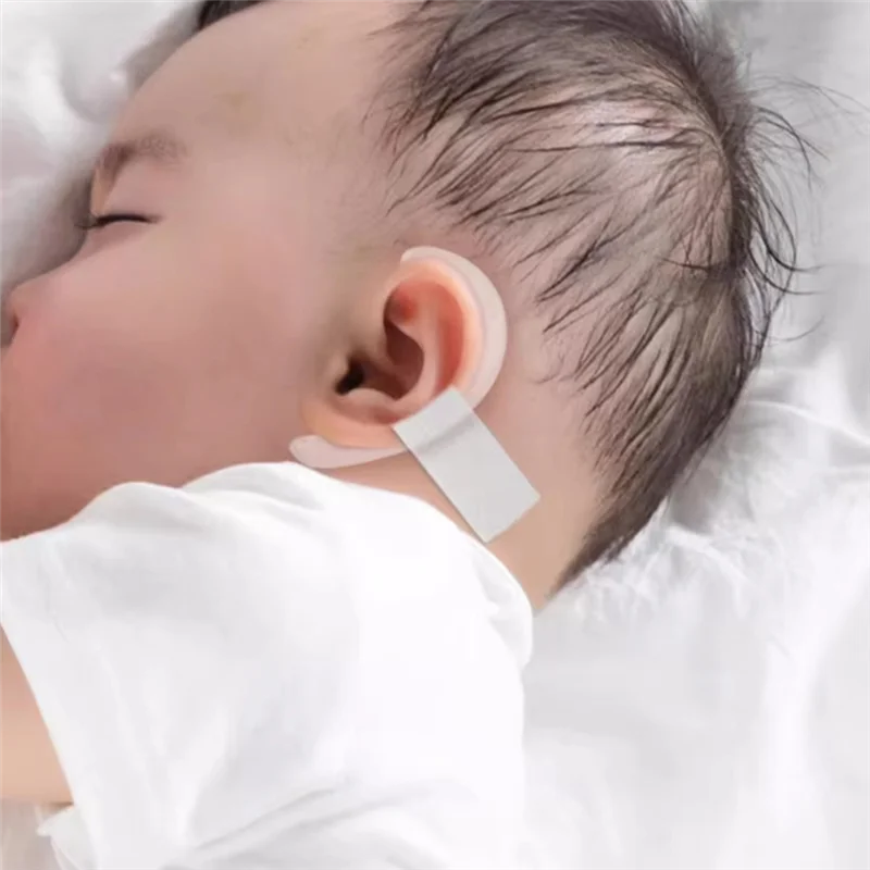 Protruding Ear Support Infant Corrector Auricle Correction Patch Baby Ear Corrector Baby Auricle Valgus Corrector
Protruding Ear Support Infant Corrector Auricle Correction Patch Baby Ear Corrector Baby Auricle Valgus Corrector