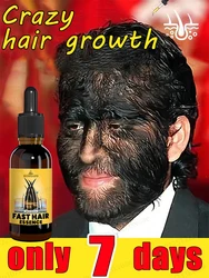 Grow cool hair secretly and surprise everyone. Say goodbye to baldness and hair loss now Grow cool hair secretly and surprise everyone. Say goodbye to baldness and hair loss now